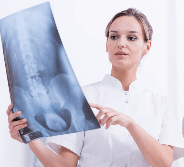 Chẩn đoán u xương lồng ngực bằng cách chụp X-quang