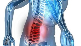 các dấu hiệu và triệu chứng của bệnh hoại tử xương thắt lưng